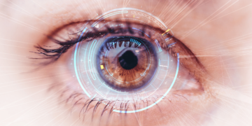 Laser de última geração para tratamento de doenças da Retina pelo SUS, no Hospital São Paulo / SPDM / UNIFESP