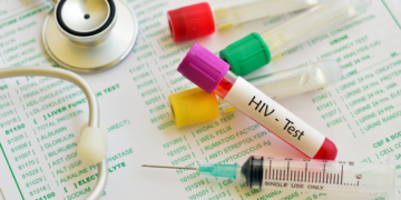 Teste rápido de HIV deve ser vendido nas farmácias a partir de fevereiro
