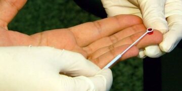 Teste rápido de HIV e hepatite C em sangue passa a ser obrigatório