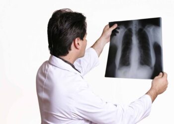 SUS começa a oferecer teste rápido para tuberculose