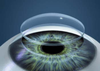 Transplante-de-cornea