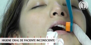 Higiene Oral do Paciente Inconsciente