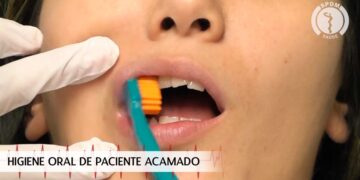 Higiene Oral do Paciente Acamado