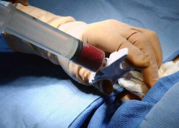 medula-20111214082110