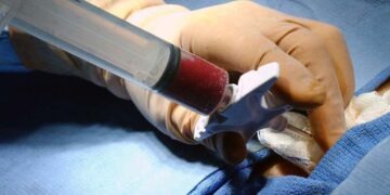 medula-20111214082110