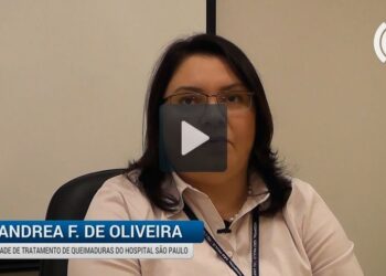 Queimaduras: proteja-se!