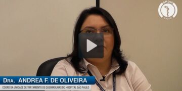 Queimaduras: proteja-se!