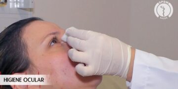 Higiene Ocular