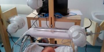 Software identifica expressões de dor em recém-nascidos