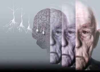 Quando o esquecimento começa a afetar o dia a dia, procure um médico. Pode ser Alzheimer!