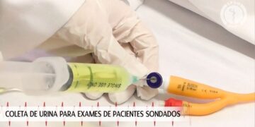 Coleta de urina para exames de pacientes sondados