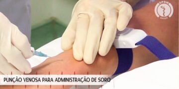 Punção venosa para administração de soro