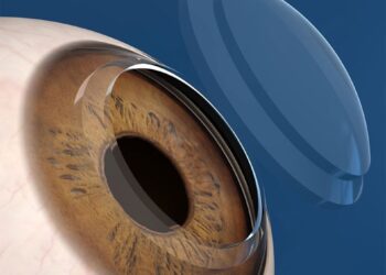 Banco de Olhos do Hospital São Paulo tem trabalho dedicado com captação