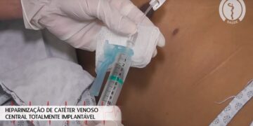Heparinização de Catéter Venoso Central Totalmente Implantável