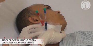 Troca de Cateter Venoso Central com gaze e fita hipoalergênica