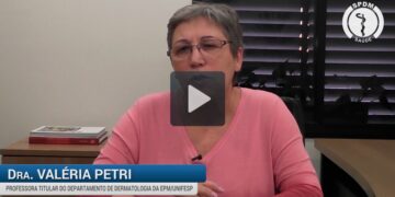 Vitiligo – causas, diagnóstico e tratamento