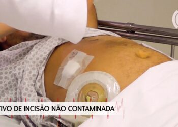 Curativo de incisão não contaminada