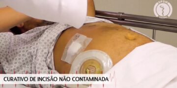 Curativo de incisão não contaminada