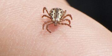 Febre Maculosa Brasileira – sintomas, diagnóstico e tratamento