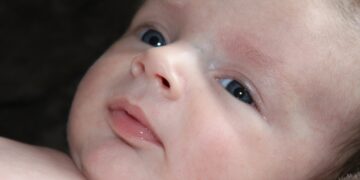 Desenvolvimento Visual da Criança Normal