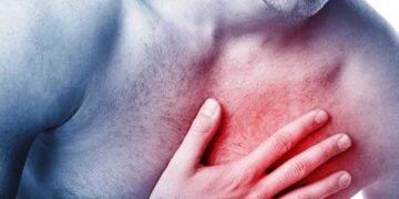 Você conhece a “Rede de Infarto São Paulo”?