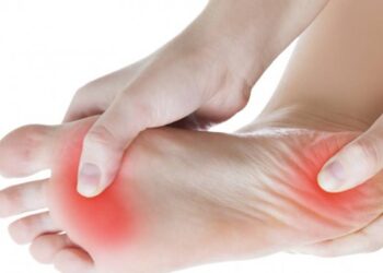 Fasceíte plantar – o que é