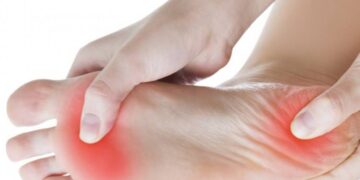 Fasceíte plantar – o que é