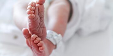 Recomendações para cuidados e assistência ao recém-nascido com suspeita ou diagnóstico de COVID-19