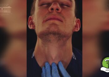 Falha de intubação – cricotireoidostomia