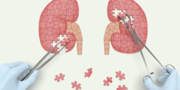 Clinical Impact, Reactogenicity, and Immunogenicity After the First CoronaVac Dose in Kidney Transplant Recipients