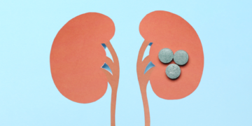 Cálculo renal – causas, sintomas e tratamento