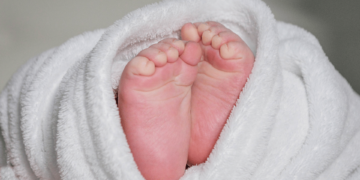 Hospital Municipal de SJC oferece atendimento especializado em Pé Torto Congênito