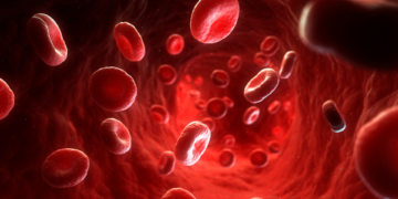 Você já ouviu falar em PBM – Patient Blood Management?