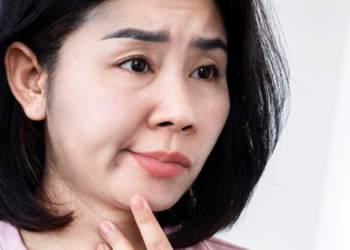 Paralisia facial – do diagnóstico ao tratamento