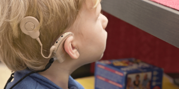 Fila de implante coclear em crianças é zerada no HSP