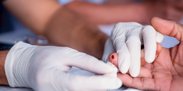 exame de sangue para identificar hiv e aids