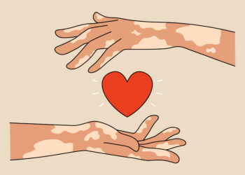 Hanseníase tem cura