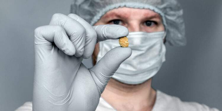 Cálculo renal prevenção