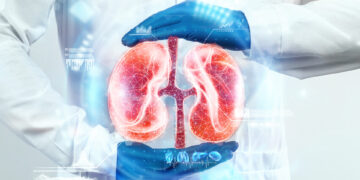 Câncer de Rim: Quais São os Fatores de Risco e Como Identificar os Primeiros Sinais?