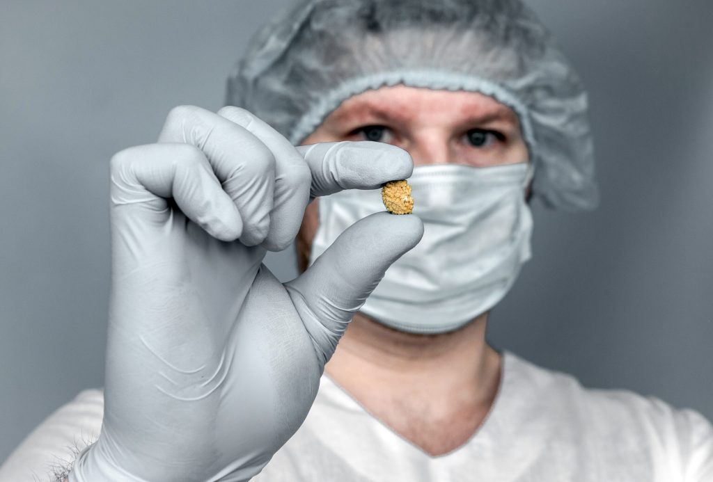 Cálculo renal prevenção|Cálculo renal sintomas|Cálculo renal - diagnóstico|Cálculo renal prevenção