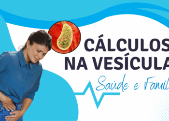 CÁLCULOS NA VESÍCULA: SINTOMAS, TRATAMENTOS E COMPLICAÇÕES