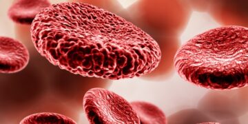 Anemia: causas, sintomas e tratamentos