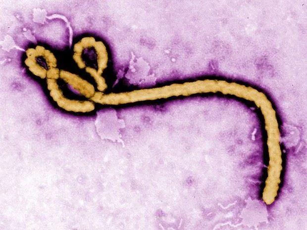 |img ebola1|img ebola2