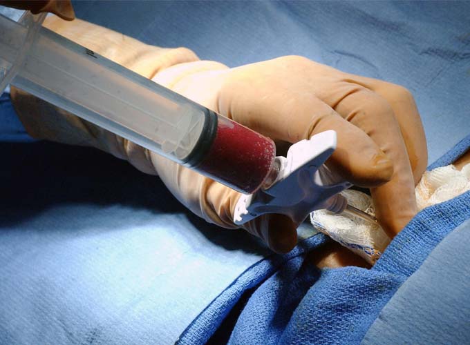 medula-20111214082110