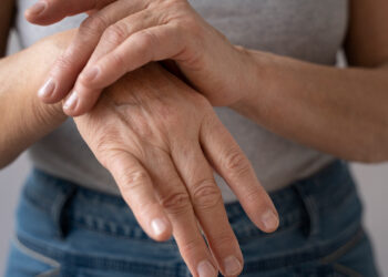 Do diagnóstico ao tratamento: como lidar com as doenças reumáticas e preservar a qualidade de vida