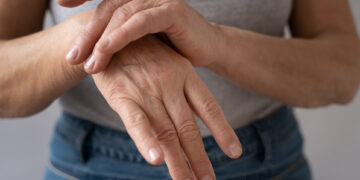 Do diagnóstico ao tratamento: como lidar com as doenças reumáticas e preservar a qualidade de vida