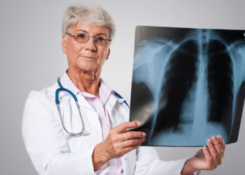 Edema agudo de pulmão: como o diagnóstico rápido e o tratamento correto podem salvar vidas