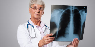 Edema agudo de pulmão: como o diagnóstico rápido e o tratamento correto podem salvar vidas