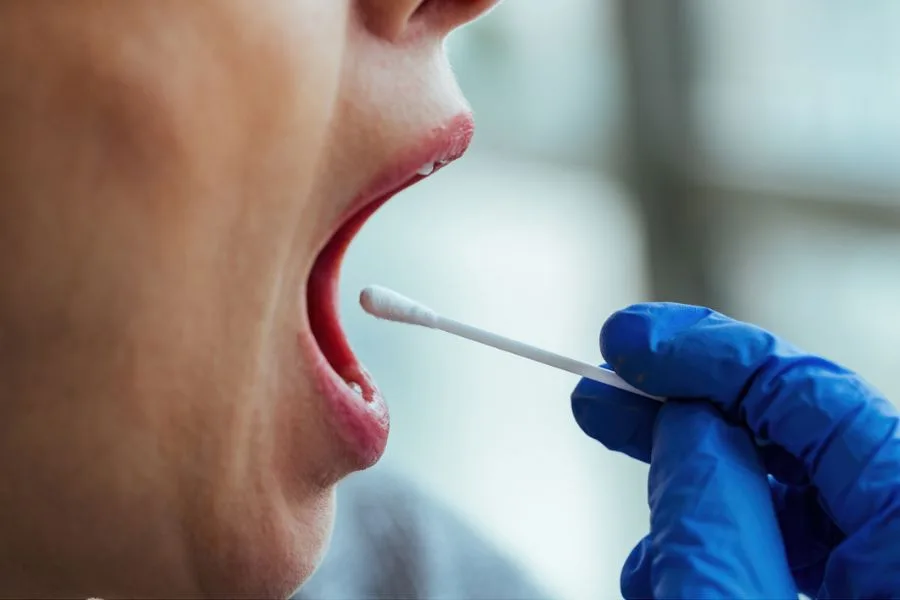 Coleta de amostra oral com swab para exame clínico.